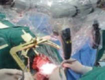 ���嶨������ϵͳ