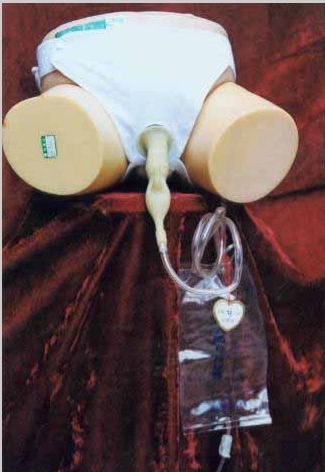 �ɳ�ϴʽ����������