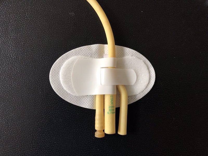 �ᱨ���̶ܹ�װ��