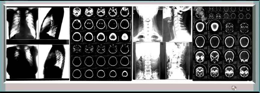 ������Ƭ��