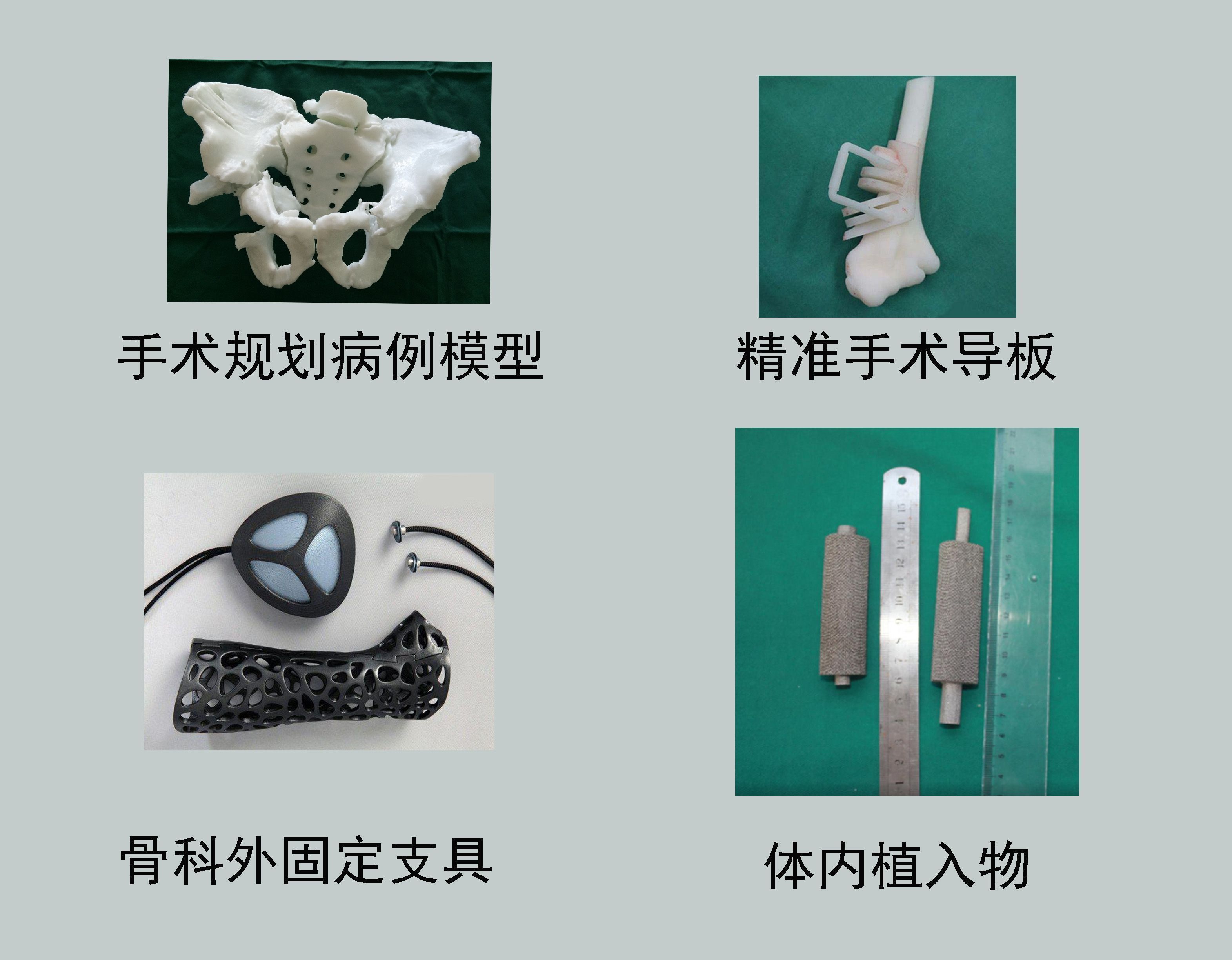 3D��ӡ����ģ�ͣ��������壬��̶�֧�ߣ�����ֲ����
