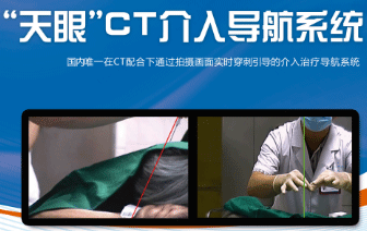 �����ۡ�CT���뵼��ϵͳ
