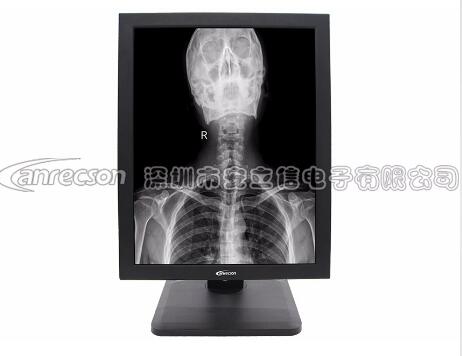 21.3Ӣ��6Mҽ�ûҽ����������ʾ��