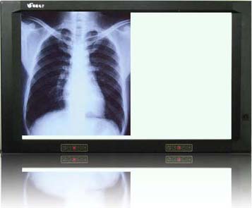 ˫����Ƭ��