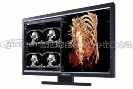 ��Ӧ������27��4Mҽ�ò�ɫ��ʾ����ȫ����ҽ�Ʋ�ɫ��ʾ��