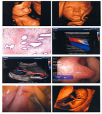 ҽ�Ʋ�ɫ����ͼ�ı���PETҽ�ý�Ƭ