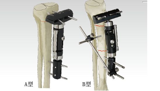 orthofix--����