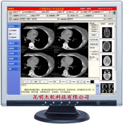 CTӰ��ϵͳ����վ