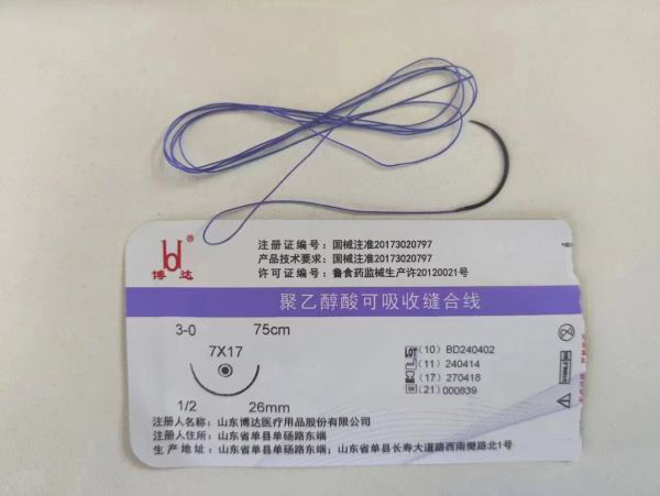 ���Ҵ�������շ���ߣ����룩