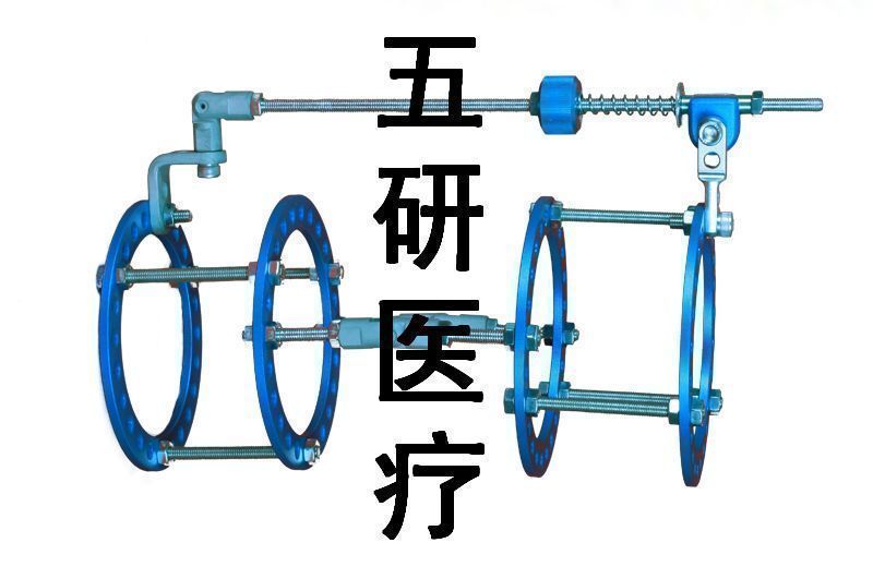 Ilizarov��̶���--��ؽڹ���