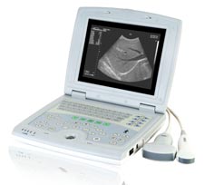 ���ֻ���ЯʽB��