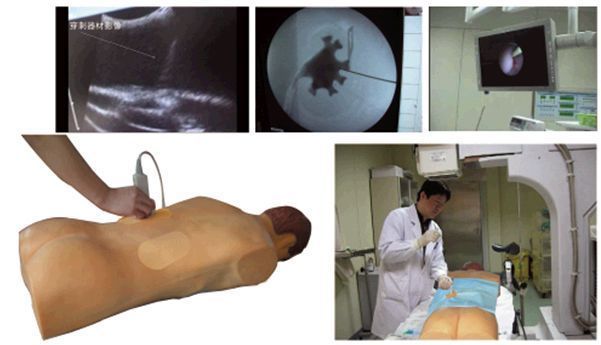 �߷��泬����X��������Ƥ������������ѵ������ģ��