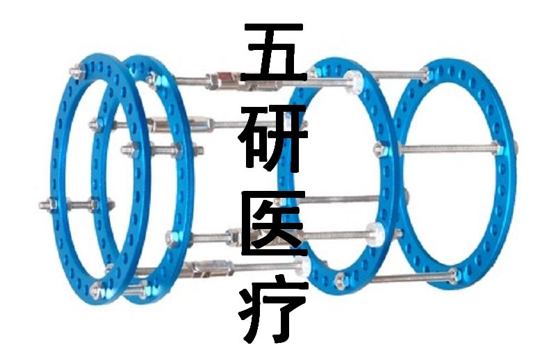 Ilizarov��̶���--�ɵ�ʽ�ǽ��Σ���ƽ�棩