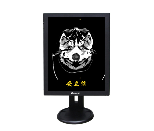2MP�ҽ�ҽ����ʾ��