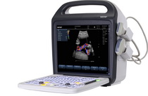 C5��Яʽ�ʳ�