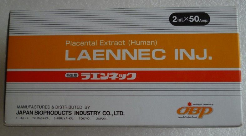 ���˿���̥��