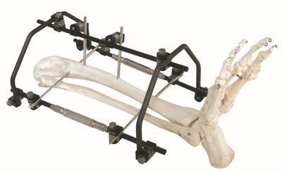 �ǿ���̶�֧��-�뻷��