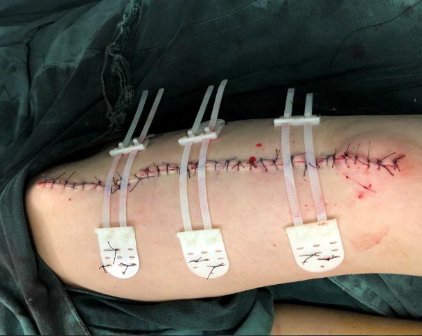 Ƥ������ǣ���պ���