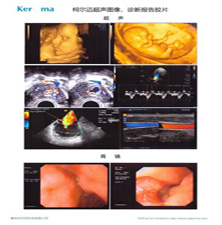 PET���ʸ���ҽ�ý�Ƭ