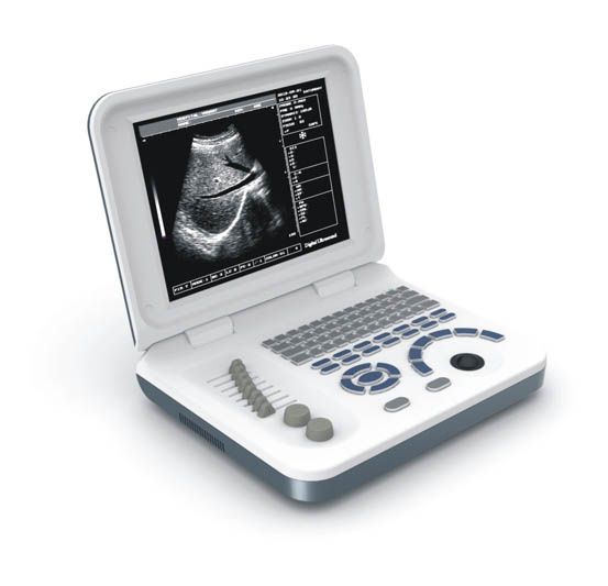 KX668ȫ����B�����ʼǱ���