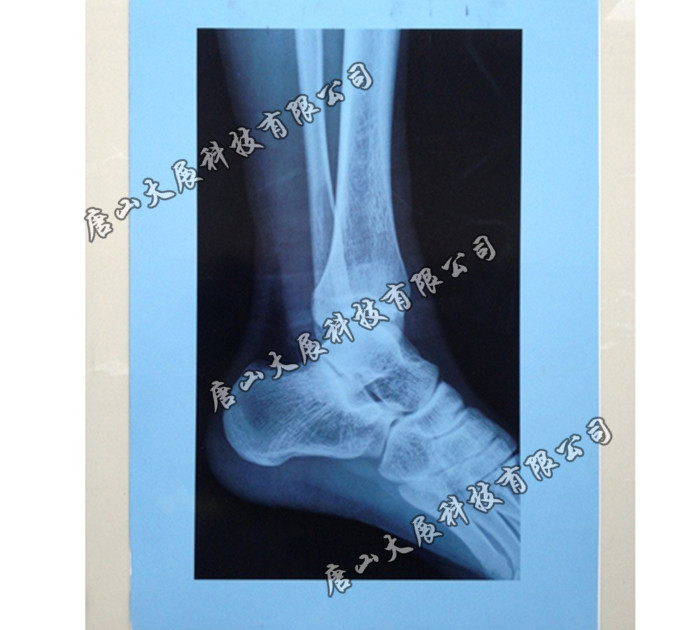 ������ī��ӡ��Ƭ