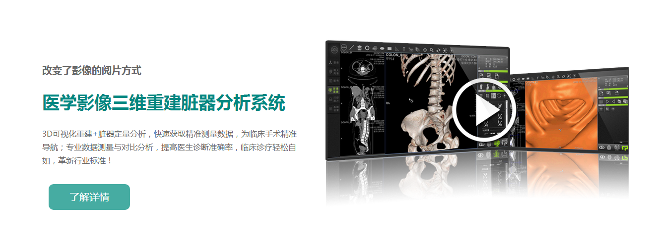 ��ά�ؽ���������ϵͳ