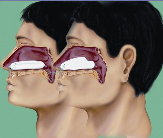 �¹�LR-���������ͺ������