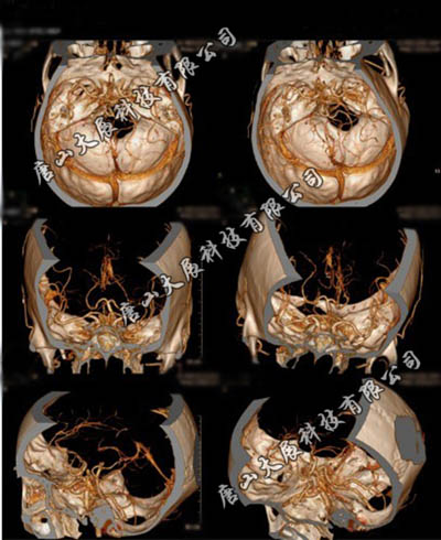 A4���ⳬ�����浥ҽ�ý�Ƭ