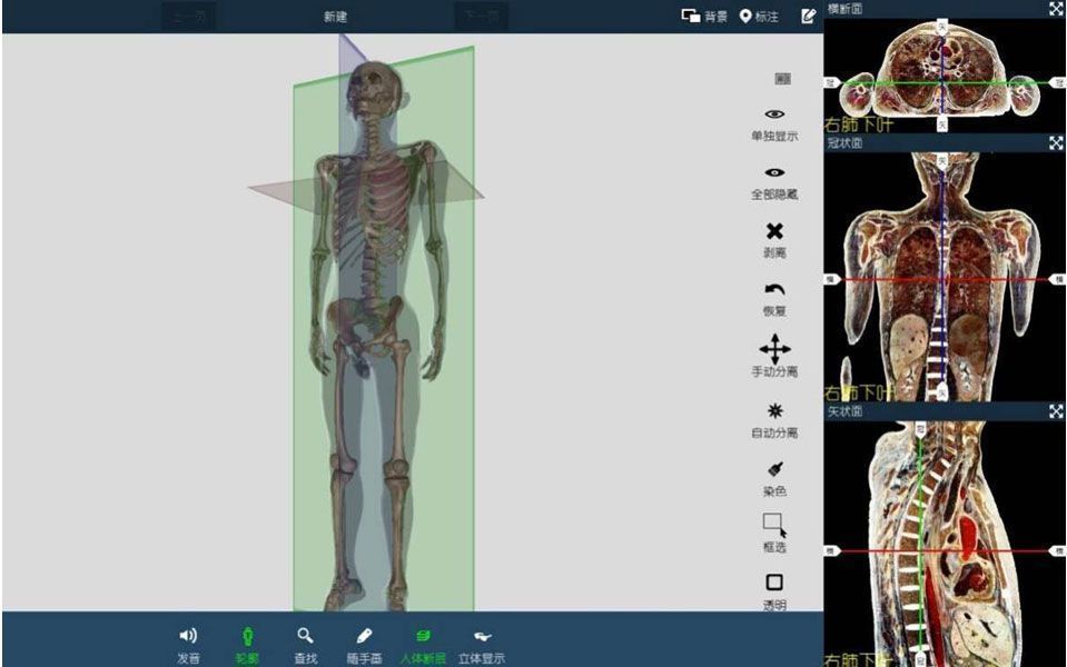 �����˽���ϵͳ�ٴ���