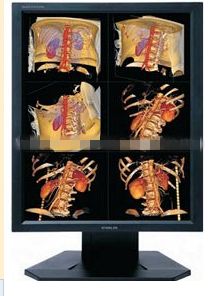 �˴Ź���(MRI)��ʾ��