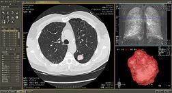 �ΰ�������������ϵͳ