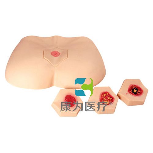 �׶��촯����ģ��