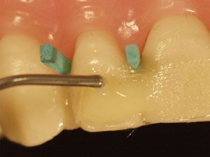 ����ǿ��ά