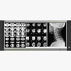 ������Ƭ��