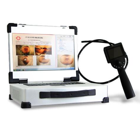 ���Ӹ�Ƶ�ۺ������ǣ�CCD΢�͵��ӽ᳦����