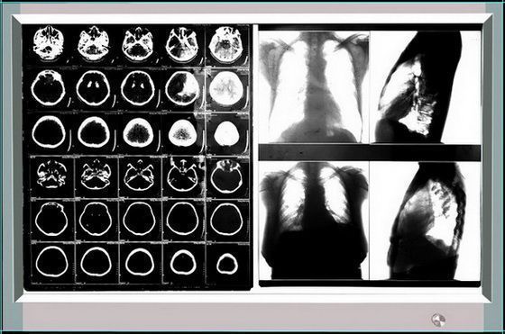 ˫�������͹�Ƭ��