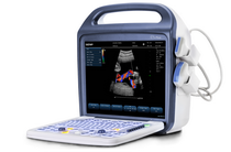 C5Plus��Яʽ�ʳ�