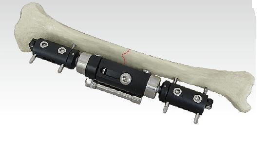 orthofix--�ֹ���