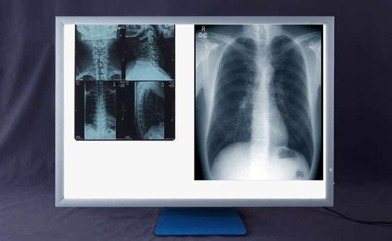 ������Ƭ��