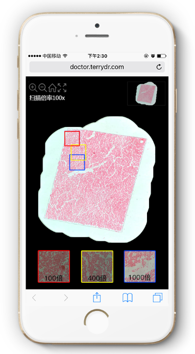 ̩�������ֲ���ȫ��Ƭɨ��ϵͳ