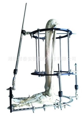 �ǿ���̶�֧��-�ֹ�