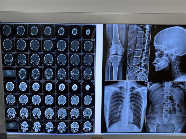 �¸���ҽ�ø�ʽ��Ƭ/������Ƭ