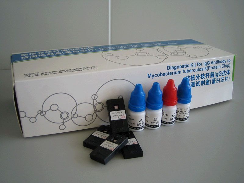 ��˷�֦�˾�IgG�������Լ��У�����оƬ��