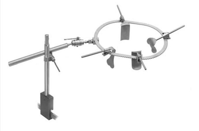 �������������е����������ǣ����Retractor