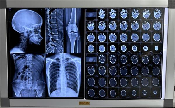 �¸���ҽ�ø�ʽ���⽺Ƭ