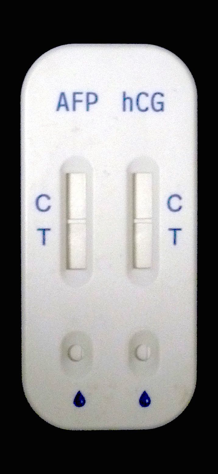 �����ۺ�֢����Լ��У�����𷨣�