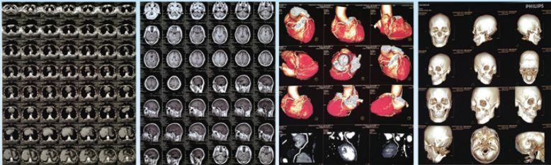 ҽ�ü��⽺Ƭ/ҽ�ø�ʽ��Ƭ