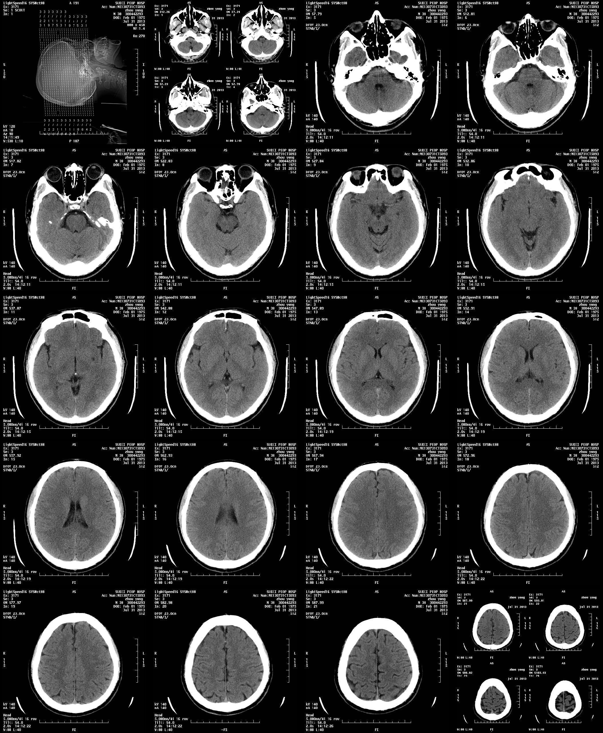 ҽ�ý�Ƭ��ҽ��x���߽�Ƭ��ҽ�ø�ʽ��Ƭ