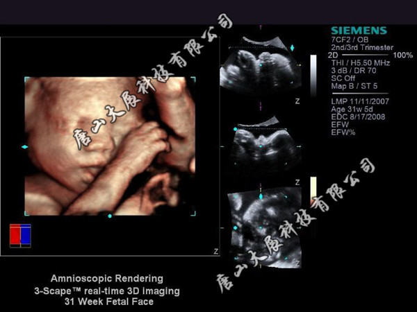 A3�����ӡ����Ƭ