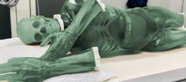 ����ȫ��ģ�� ������X����/CT��MRI������